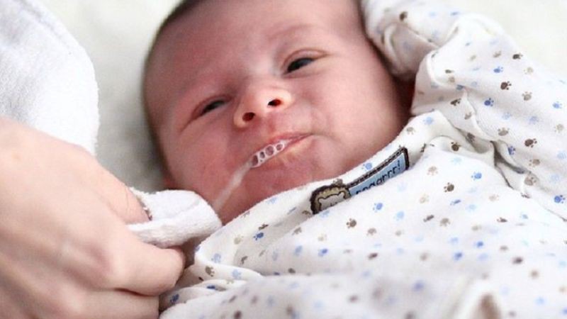 Bé bị trào ngược dạ dày - thực quản