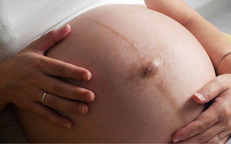 Không nên chạm vào rốn mẹ bầu