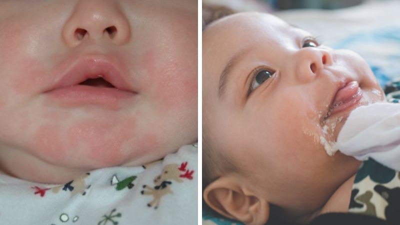 Nhược điểm khi cho bé ngủ chổng mông