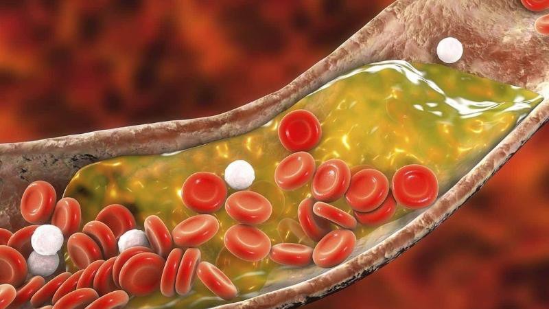 Giảm Cholesterol