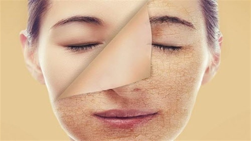 Mandelic Acid có tác dụng tẩy da chết