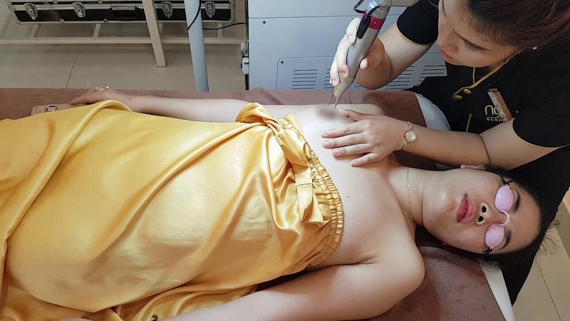 Xăm hồng nhũ hoa