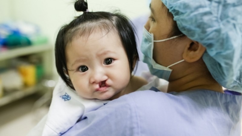 Vì sao không nên phẫu thuật hở hàm ếch quá sớm?