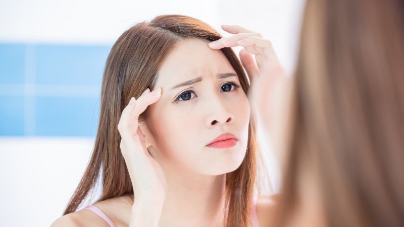 Nguyên nhân hình thành nếp nhăn trên trán
